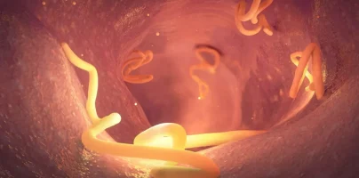 Parasitäre Infektionen beim Menschen
